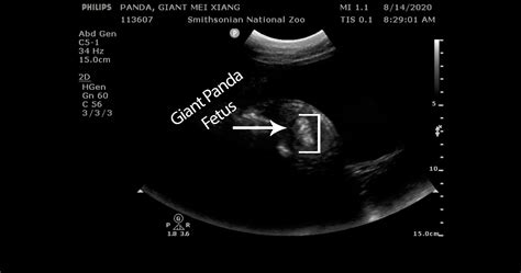 Veterinarians Find Fetal Tissue on Giant Panda Ultrasound | Smithsonian Institution