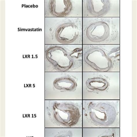 Representative images of cellular plaque composition at histology.... | Download Scientific Diagram