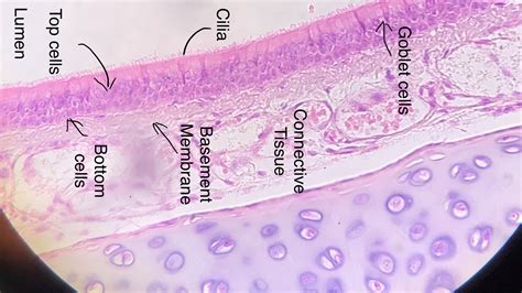 Pseudostratified Columnar Epithelium