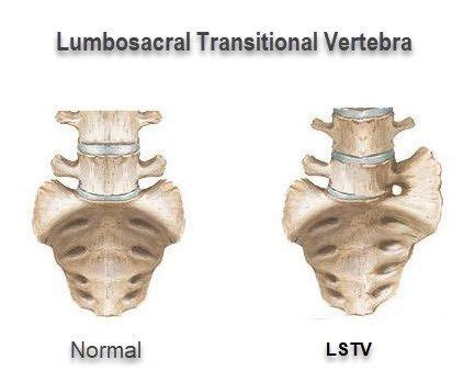 Pin on Musculoskeletal Health