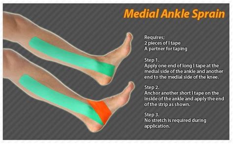 ankle taping kinesio - Google Search Ankle Taping, Kt Tape Ankle Sprain, Physio Tape, Ankle ...