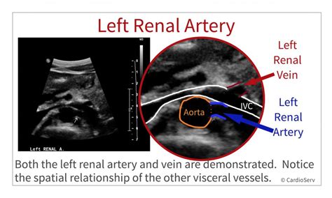 Renal Artery Branches Anatomy