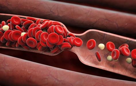 6 Signs You Might Have a Blood Clot - Bicycling