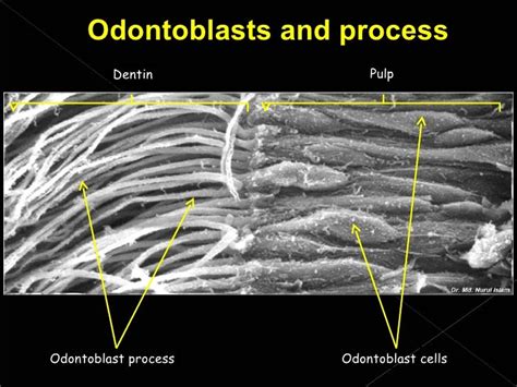 Histology of dentin