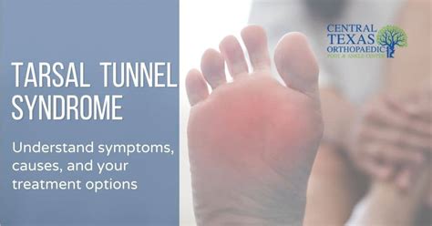 Understand the Symptoms and Causes of Tarsal Tunnel Syndrome