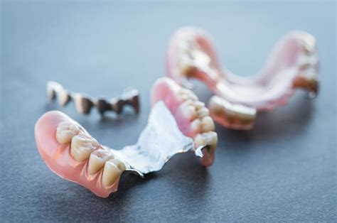 The Pros and Cons of Metal Partial Dentures, Explained - Swikriti's Blog