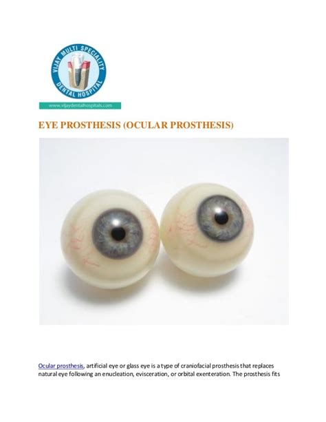 Eye prosthesis