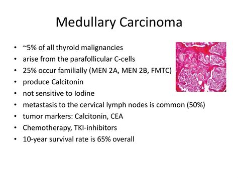 Thyroid cancer - online presentation