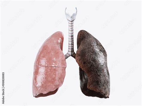 Realistic 3d illustration of healthy human lungs vs smoker lungs ...