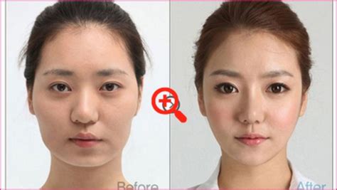 Surgery To Make Eyes Bigger Before And After | rosesandmakeupp