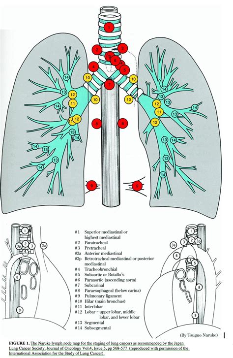 Naruke lymph node map (Japan Lung Cancer Society)