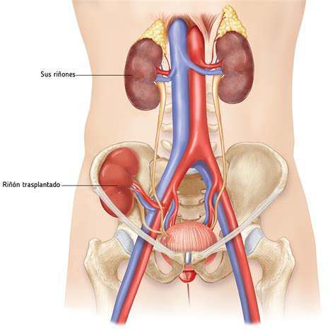 Trasplante renal – Alcer Gipuzkoa