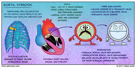 Aortic Stenosis | Medcomic | Aortic stenosis, Pathophysiology nursing ...