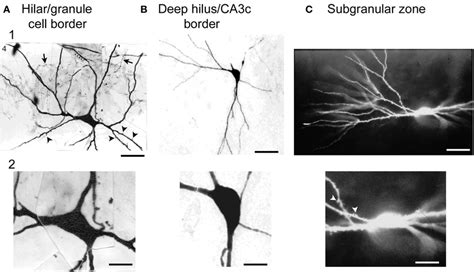 Large cells of the hilus are not always mossy cells. (A) A ...