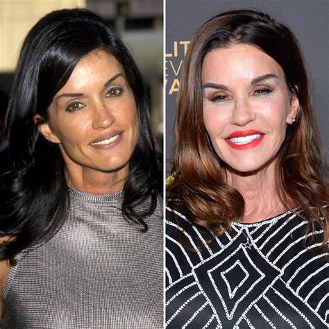 Celebrity Facelifts and Plastic Surgery: See Then-and-Now Pics