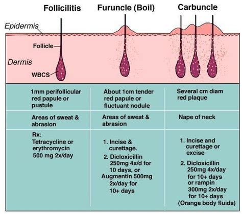 Fruncule / Boil vs Carbuncle ... See tried | Keratosis pilaris ...