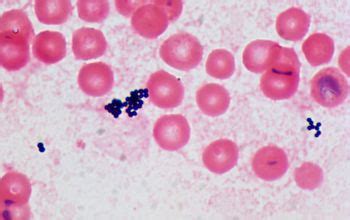 Staphylococcus Saprophyticus Gram Stain