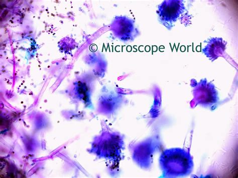 Microscope World Blog: Mold Under the Microscope