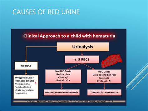 Hematuria in children