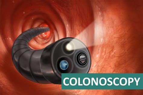 Colonoscopy in Ahmedabad | Dr. Bhavesh Thakkar