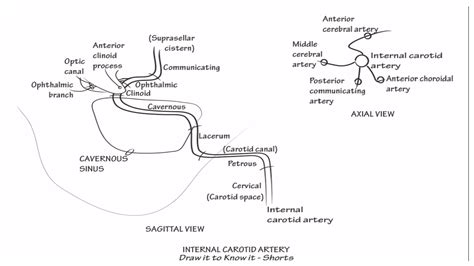 Neuroanatomy: Internal Carotid Artery | Draw It to Know It