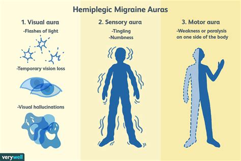 What Is A Hemiplegic Migraine Stroke - Peter Brown Bruidstaart