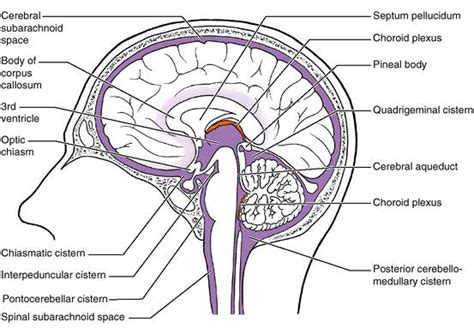 ABC Radiology Blog: Brain Ventricular System