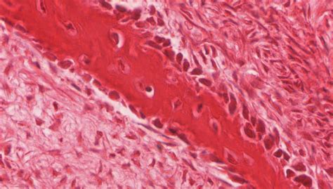 Bone and Bone Formation | histology