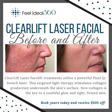 Before and After Clearlift Facial - Feel Ideal 360 Med Spa - Southlake, TX