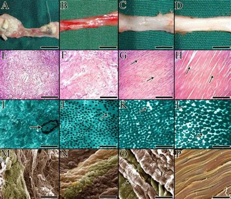 Figure 3: Three different stages of tendon healing under gross ...