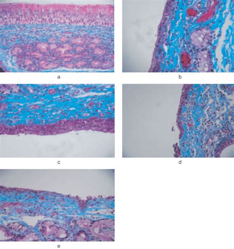 Images from the histological evaluation of nasal mucosa; control (a ...