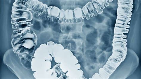 Acute Abdomen: an Approach to Diagnosis and Management - Doctorable