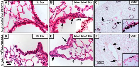 Clara Cell Histology