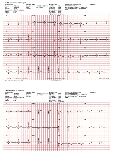 Universal ECG Sample Reports | PDF | Electrocardiography | Heart