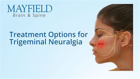 Trigeminal Neuralgia Treatment