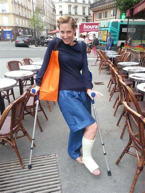 lady with legcast on crutches | Fashion, Leg cast, Style