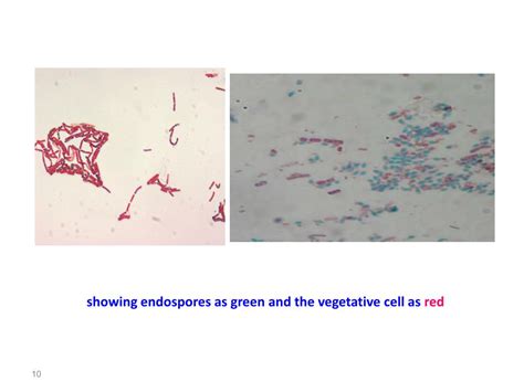 PPT - Diagnostic microbiology lecture: 11 Gram Positive, Endospore -Forming Bacilli THE GENUS ...