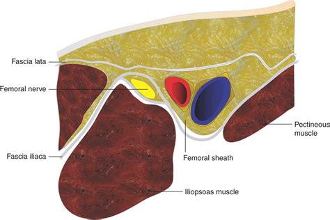 Femoral Nerve Block | Anesthesia Key