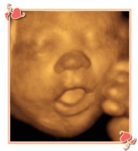 Gallery, My Sunshine Baby 3D/4D Ultrasound in Charlotte, NC, Charlotte, 3d ultrasound, prenatal ...