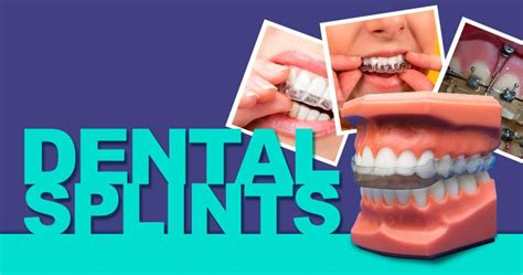 Types of Dental Splints for TMJ (Temporomandibular Joint Disorders)