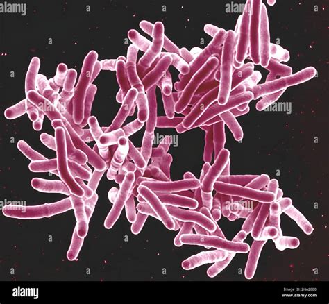 Micrografía electrónica de Mycobacterium tuberculosis, la bacteria que ...