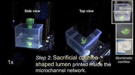 剑桥大学科学家研发新一代个性化人工耳蜗模型，模拟耳蜗导电性能，回国加盟顶尖高校 - 知乎