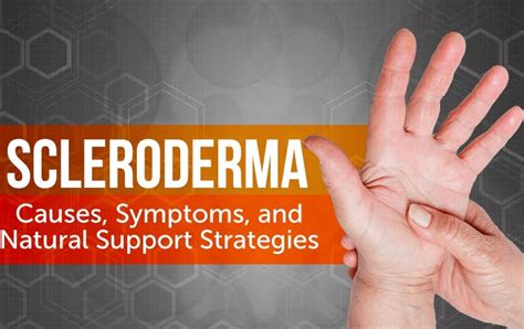 Natural Treatment of Scleroderma - Functional Medicine Australia