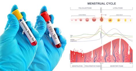 Lh To Fsh Ratio - Reproduction Online
