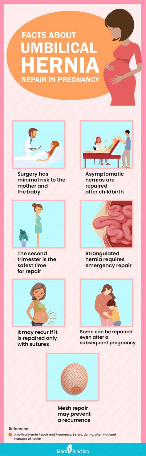 Umbilical Hernia Symptoms And Treatment – NBKomputer