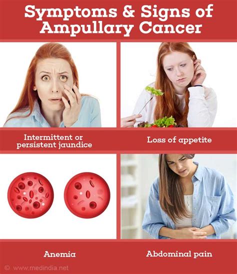 Ampullary Cancer Causes Symptoms Diagnosis Treatment