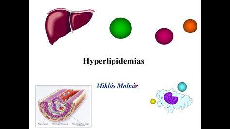 Pathophysiology of Hyperlipidemia - YouTube