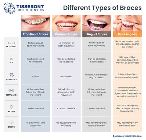 Types of Braces - Tisseront Orthodontics