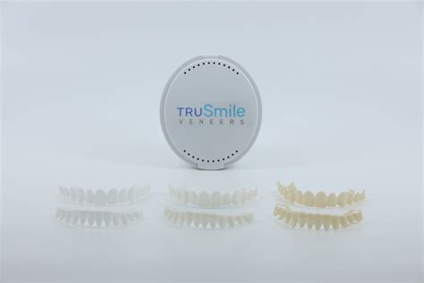 TruSmile Custom Made Veneers – TruSmile Veneers