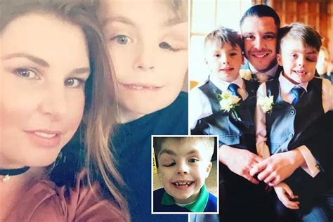 Mum of boy, 8, with 'Elephant Man' syndrome that has left him with face ...